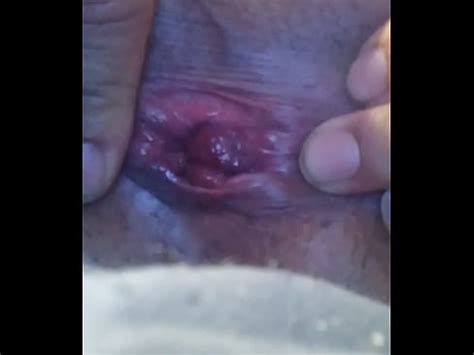 Hermafrodita XVIDEOS