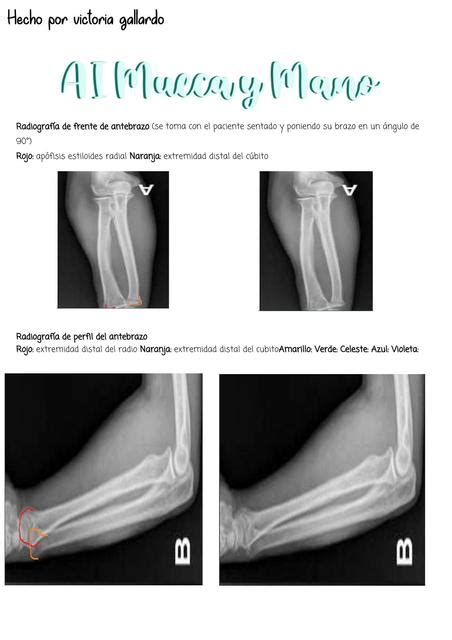 Anatomia Por Imagenes Radiologia Victoria Gallardo UDocz