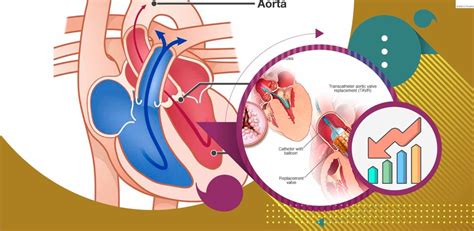 Guidelines de Estenose Aórtica thevalveclub