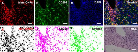 targeted imaging  cd expressing tumor