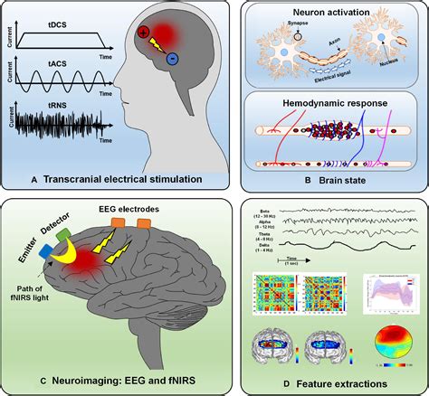 Deep Brain Stimulation Indications And Applications 4