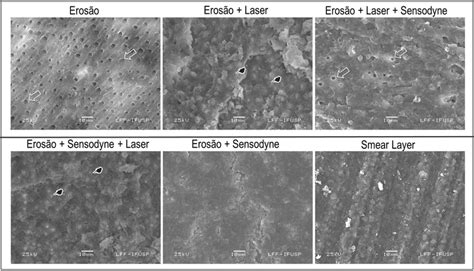 Photomicrographs of treatments (magnification × 1000; Bar = 10 μm ... 
