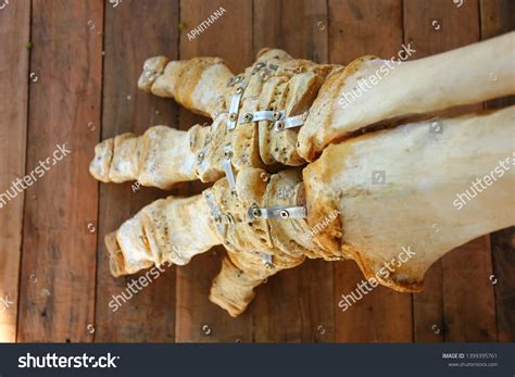 Anatomy Elephant Foot Elephantiasis Bone Stock Photo 1399395761 ...