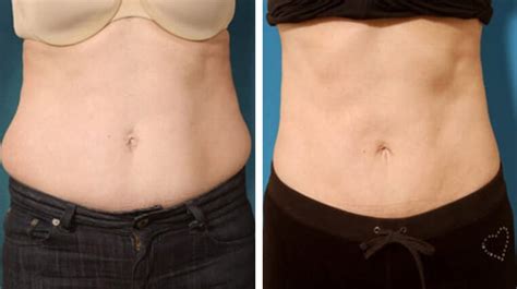 Акваликс в Калининграде: записаться на прием | Формула Красоты