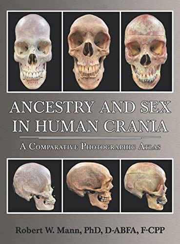 Ancestry And Sex In Human Crania A Comparative Photographic Atlas Auckoo Store