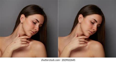 Hundred Before After Naked Woman Royalty Free Images Stock Photos Pictures Shutterstock