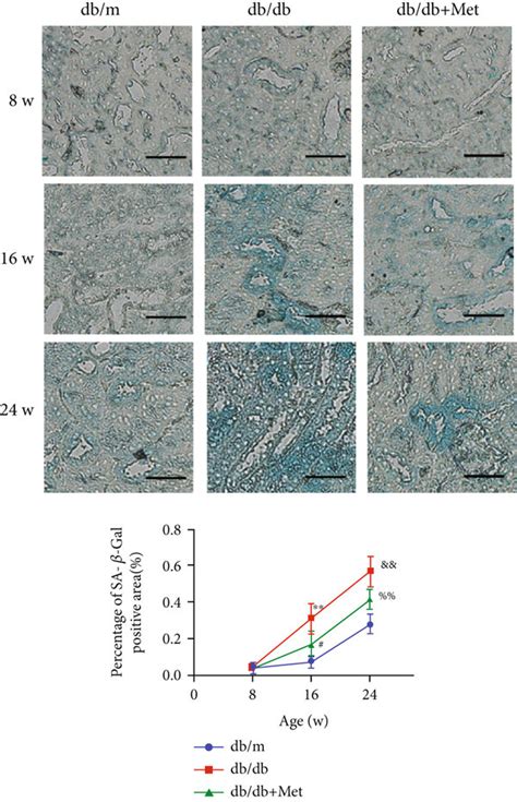 Metformin Reduced The Senescence Of Renal Tubular Epithelial Cells In