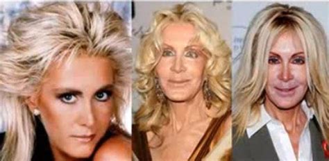 15 Most Terrifying Celebrity Plastic Surgery Fails Sad Plastic