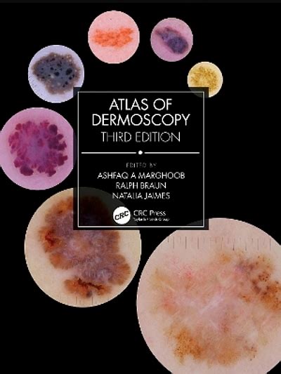 Atlas of dermoscopy | WorldCat.org