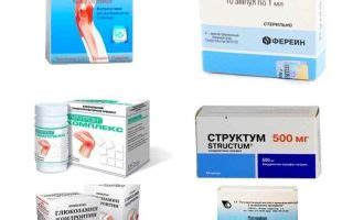 Перечень таблеток от артроза суставов: список эффективных лекарств и их ...