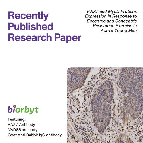 Biorbyt on LinkedIn: #research #musclephysiology #congratulations # ... 