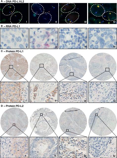 Frontiers Pd L1 And Pd L2 Expression In Cervical Cancer Regulation