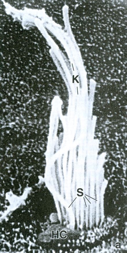 41 Вестибулярная волосковая клетка и отолиты