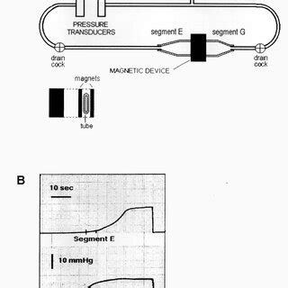 Magnetic Anal Sphincter Augmentation Device Closed Left And Open