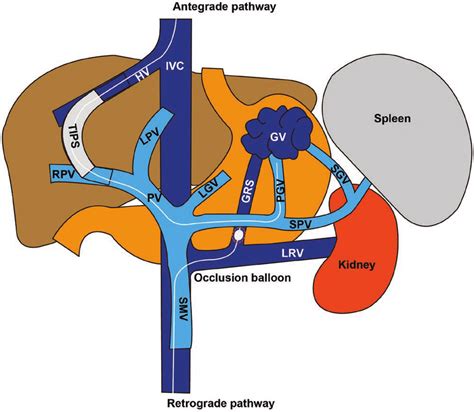 The Schematic Diagram Of Baato Tips Procedure Which Demonstrates The