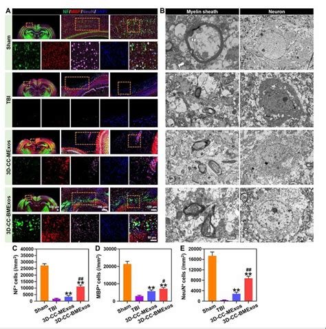 The Recovery Of Nerve Fibers Myelin Sheaths And Neurons At The Injury