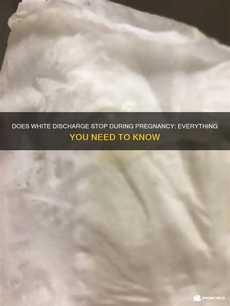 Does White Discharge Stop During Pregnancy Everything You Need To Know