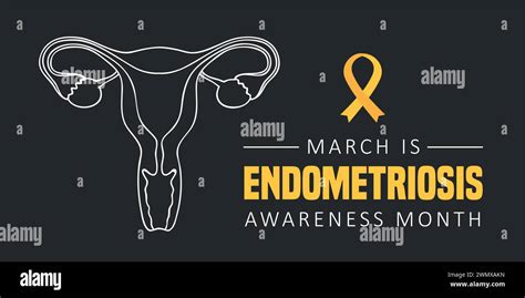 National Endometriosis Awareness Month March Info Graphic Vector Illustration Stock Vector Image