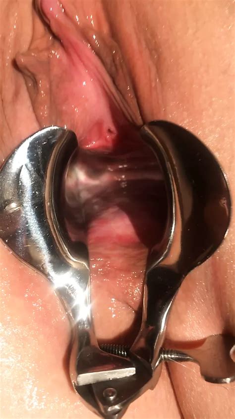 Speculum Sex Toys Pussy Sexe Toys Porn Video XHamster XHamster