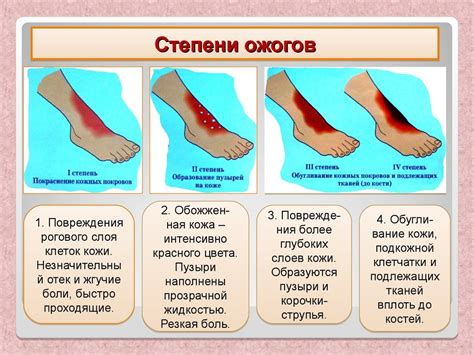 Что делать после ожога, и какое средство лучше помогает в лечение?