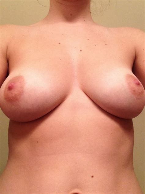 Beautiful Speckled Boobs Porn Pic