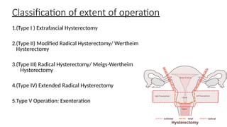 Surgical Management Ca Cervix And Its Nursing Management Pptx