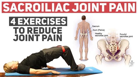 Sacroiliac Joint Dysfunction