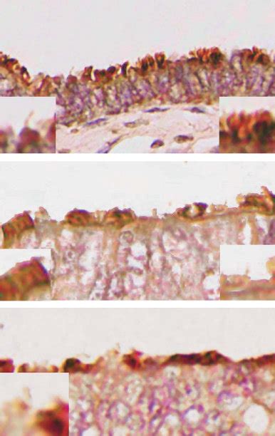 Dual Ihc Staining Of Normal Human Ft At The Fimbrial End The Axonemes