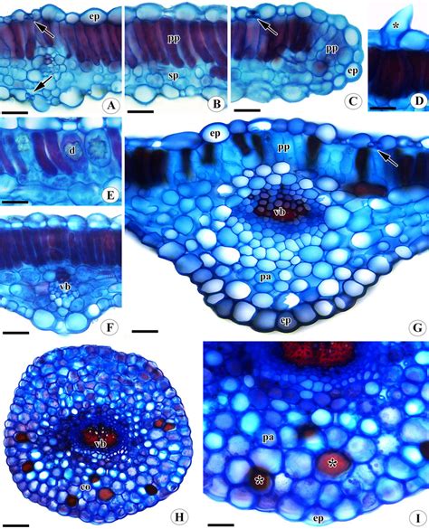 Cross Sections Of Phyllanthus Pterocaulis Leaf Blade And Petiole A F