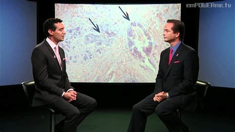 Breast Cancer With Dr Jay Granzow Md Vod Youtube