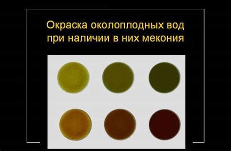 Цвет околоплодных вод