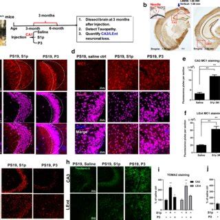 Oligomeric Tau co-localized with TIA1 positive granules in soma of ... 