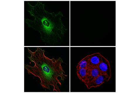 CEMIP E8Y4R Rabbit MAb Cell Signaling Technology