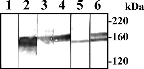 Characterization Of Entamoeba Histolytica Intermediate Subunit Lectin Specific Human Monoclonal