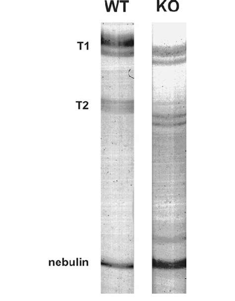 SDS Agarose Gel Electrophoresis Of Control And Knockout Muscle