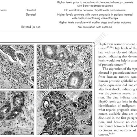 Immunohistochemical Detection Of Hsp60 Provides Useful Insights For