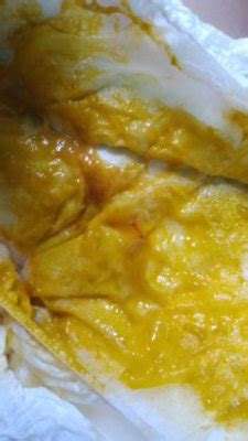 Coco De Crianca Com Sangue - SINAL DE SANGUE NO COCÔ DO BEBÊ | BabyCenter