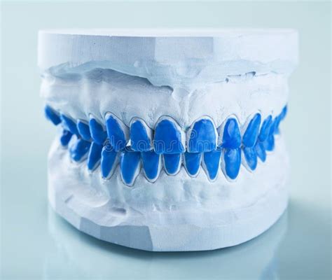 Individual Plaster Dental Molds To Make Trays Stock Photo Image Of