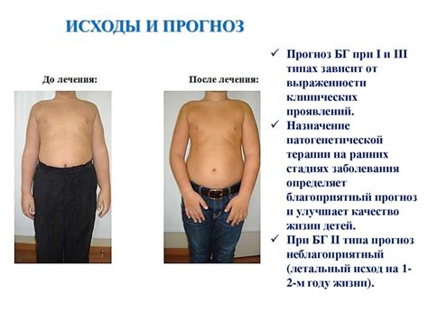 Болезнь Гоше - презентация онлайн