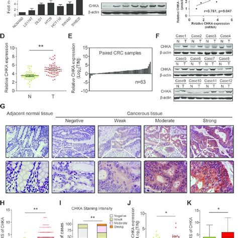 Increased Expression Levels Of Chka In Crc Cell Lines And Clinical