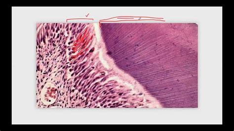 Histolog A De La Pulpa Dental Esquema Conceptual Youtube
