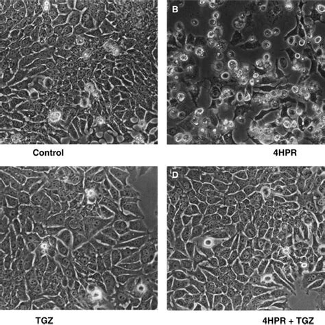 Effect Of Retinoids And PPAR Agonists On Breast Cancer Cell Growth