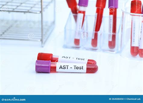 Ast Test To Look For Abnormalities From Blood Stock Photo Image Of