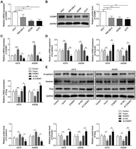 Cadm Downregulates The Emt Process In Melanoma Relative Expression Of