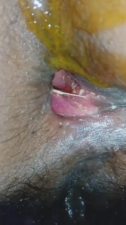 Spectacular Moment From First Anal Sex In My Life Very Painful Anal Intercourse Xhamster
