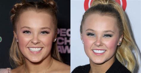 JoJo Siwa Explained How Her Gay Awakening Started