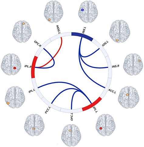 Frontiers Regional Neural Activity Abnormalities And Whole Brain