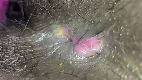 Extreme Nahaufnahme Anal Tiefes Fingerndes Arschloch Xhamster