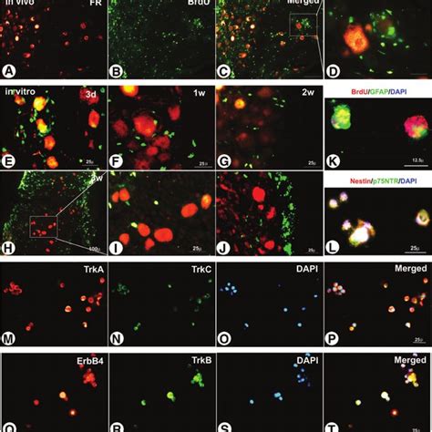 Cells Migrating From Adult Dorsal Root Ganglia Drg Explants Form