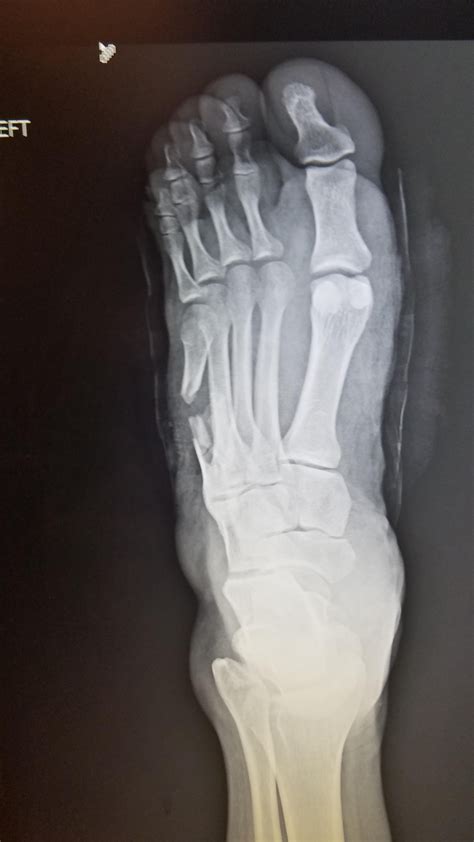 WARNING CONTAINS graphic laceration image. : r/Radiology